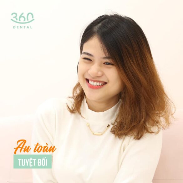 Case lâm sàng 6 mặt dán sứ veneer emax