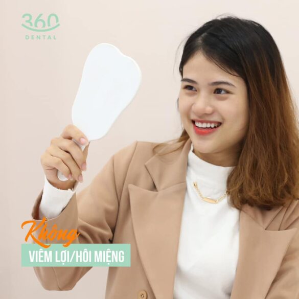 Case lâm sàng 6 mặt dán sứ veneer emax